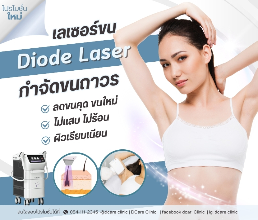 Diode Laser